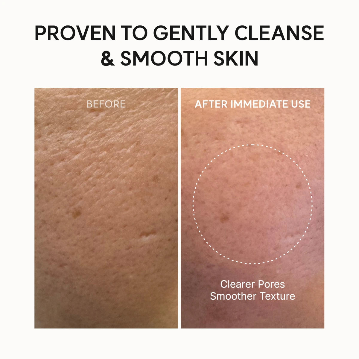 Arencia Fresh Rosehip Mochi Cleanser 120g