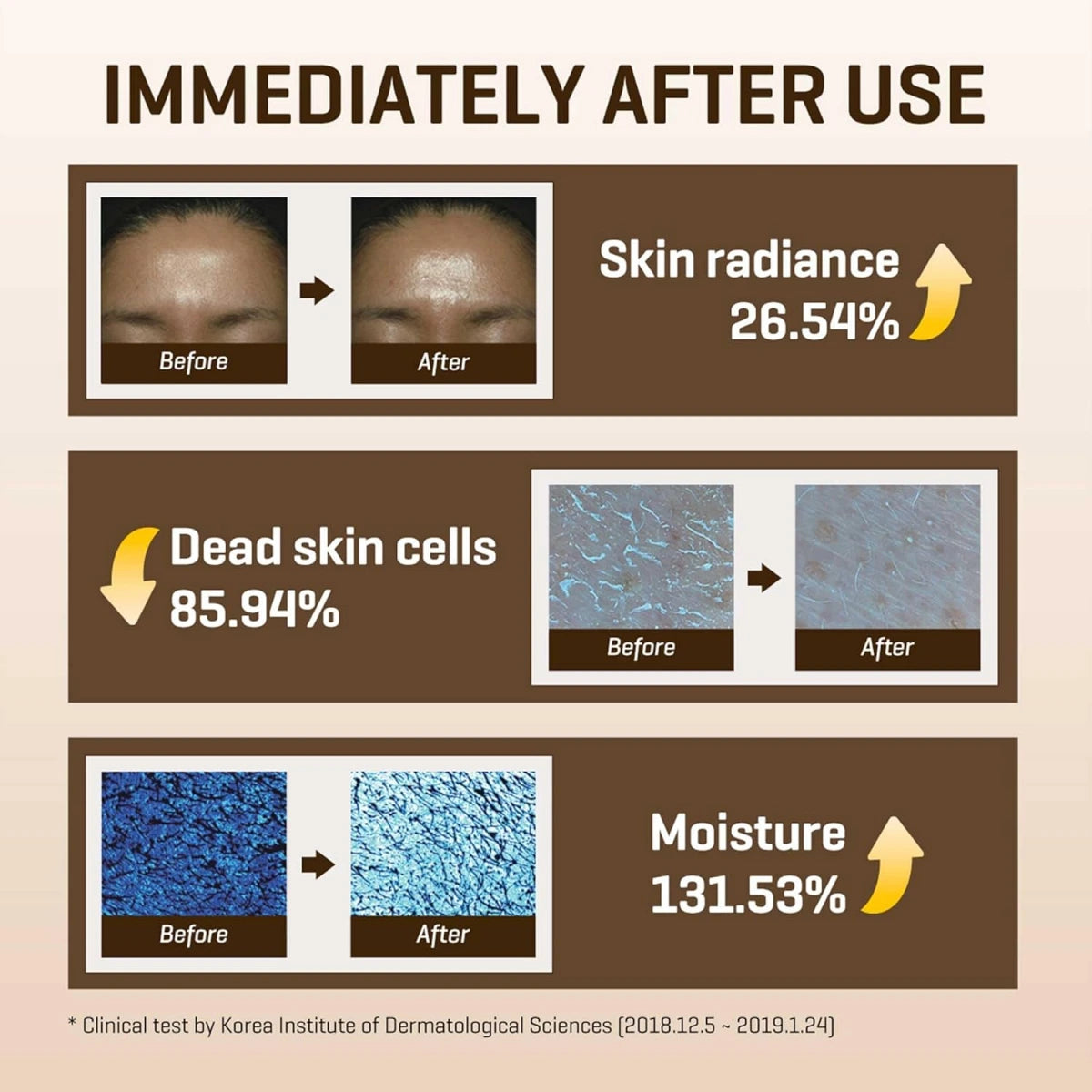 SOME BY MI Galactomyces Pure Vitamin C Glow Toner - 6.76Oz, 200ml